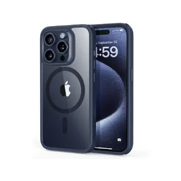 Johnson Baby Oil Aloe Vera